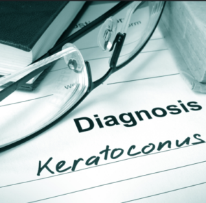 My Keratoconus Journey: A Story of Fear, Recovery, and Hope